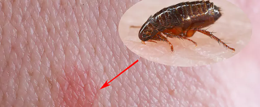 Flea Control for Humans Schertz, TX